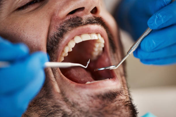 Best Emergency Dentist for Knocked-Out Tooth in Cumberland, KY
